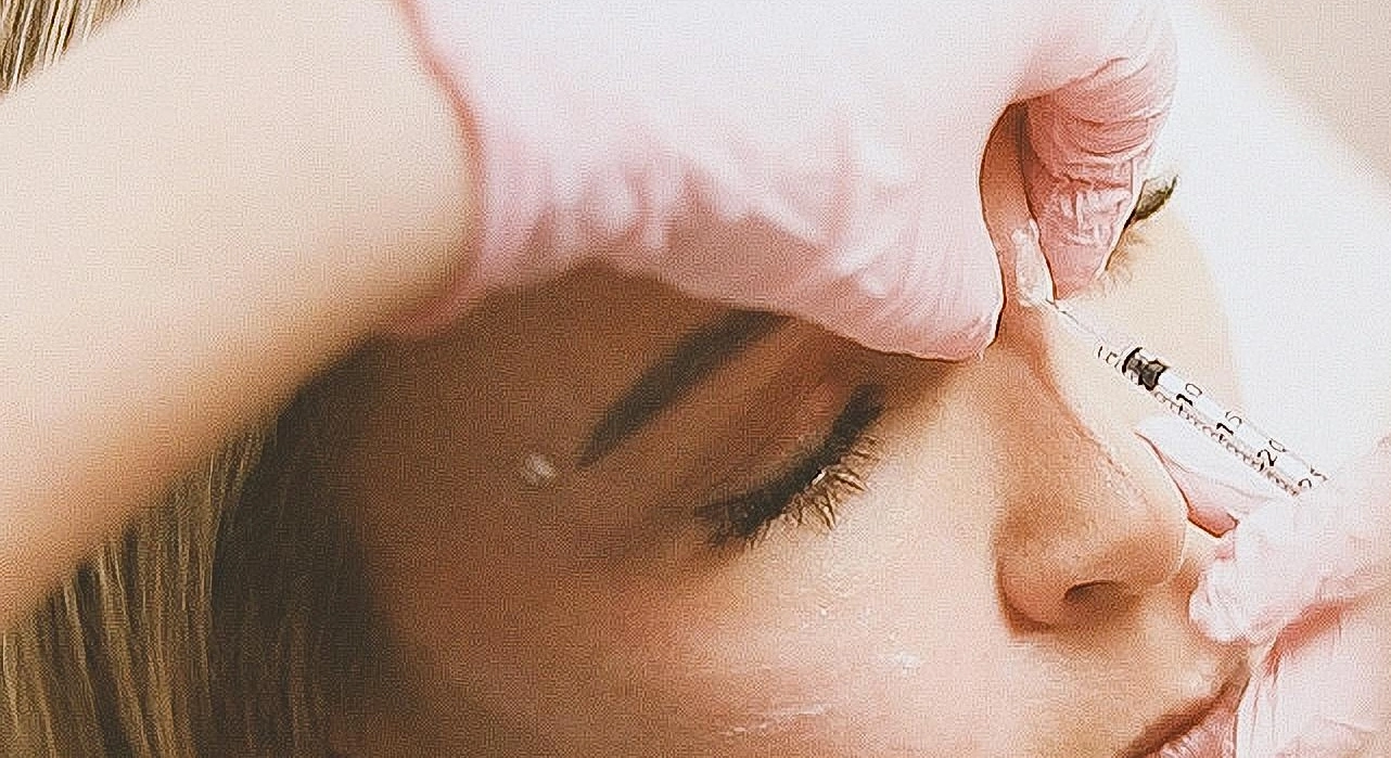 Nose slimming Botox anvendes til at give næsen et smallere og mere harmonisk udtryk